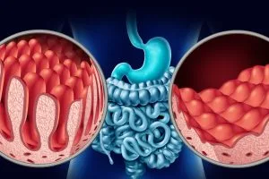 Ali je celiakija resna bolezen?